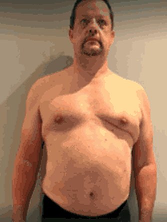 Al before
